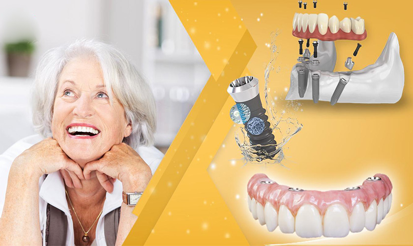 The role of temporary teeth in dental implants